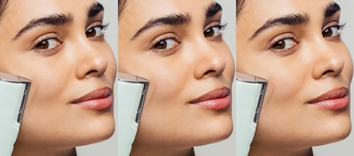 6 Best Facial Hair Removal Tools For Silky Smooth Skin